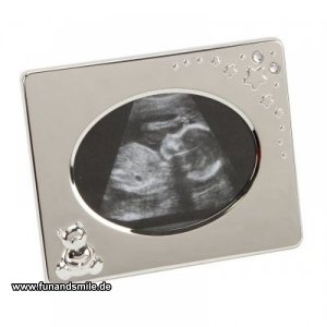 Fotorahmen für das Ultraschallbild