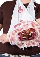 Offener Knochenbruch Wunden-Verband