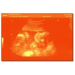 Ultraschallbild Kunstdruck